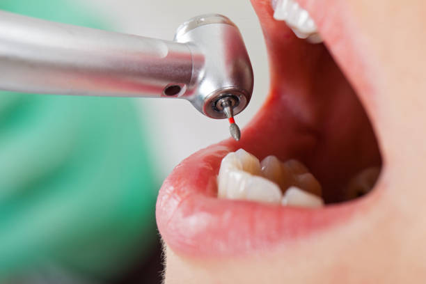 Best Tooth Infection Emergency Dentist  in Elm Creek, TX